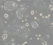 SW1116（人结肠腺癌细胞）