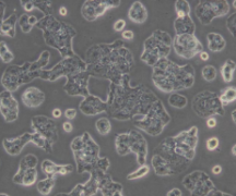 Beta-TC-6（小鼠胰岛素瘤胰岛β细胞）