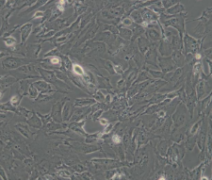 hFOB 1.19（人SV40转染成骨细胞）