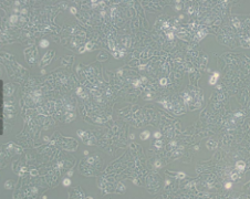 MS751（人子宫颈表皮癌细胞）