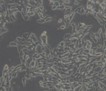 TT（人甲状腺导管癌细胞）