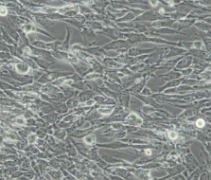 U-118 MG（人脑星形胶质母细胞瘤）