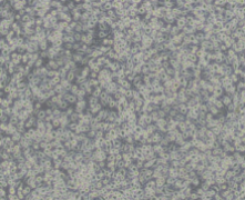 U266（人多发性骨髓瘤细胞）