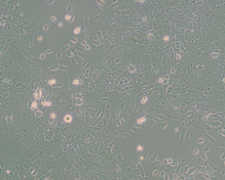 MCF 10A（人正常乳腺上皮细胞）