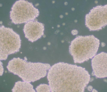 NK-92（人恶性非霍奇金淋巴瘤患者的自然杀伤细胞