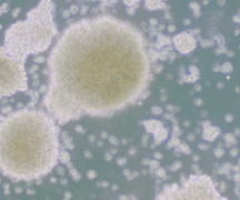 NK-92MI（人恶性非霍奇金淋巴瘤患者的自然杀伤细