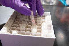 食物塑造了你的基因——戒不掉的碳水化合物